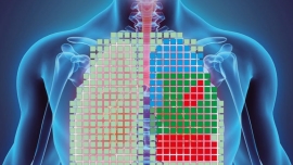 تولید جلیقه پیشرفته برای بیماران ریوی توسط محققان آلمانی High-tech textile vest for lung patients